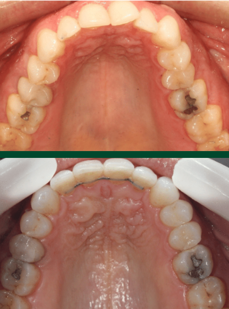 Antes e depois de paciente da Massa Odontologia