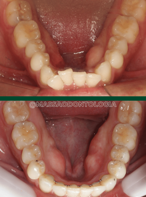 Antes e depois de paciente da Massa Odontologia
