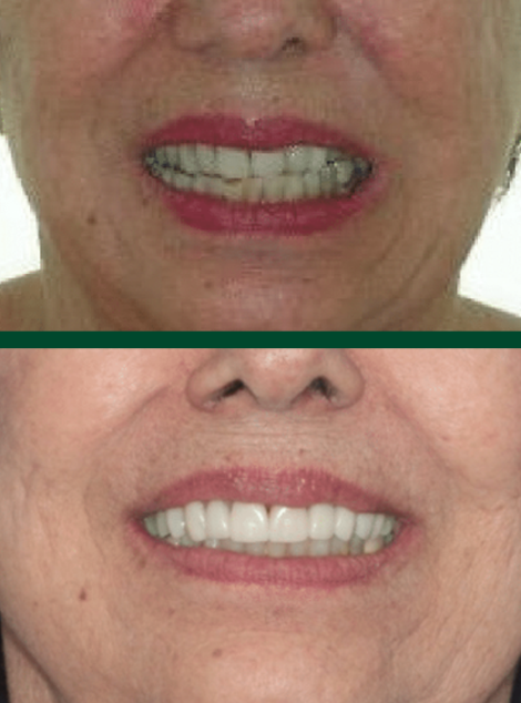 Antes e depois de paciente da Massa Odontologia