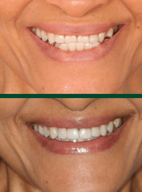 Antes e depois de paciente da Massa Odontologia