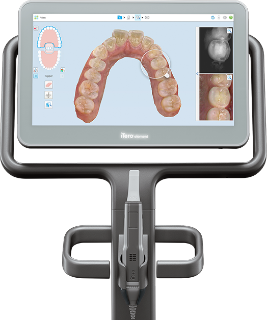 Escâner intraoral iTero